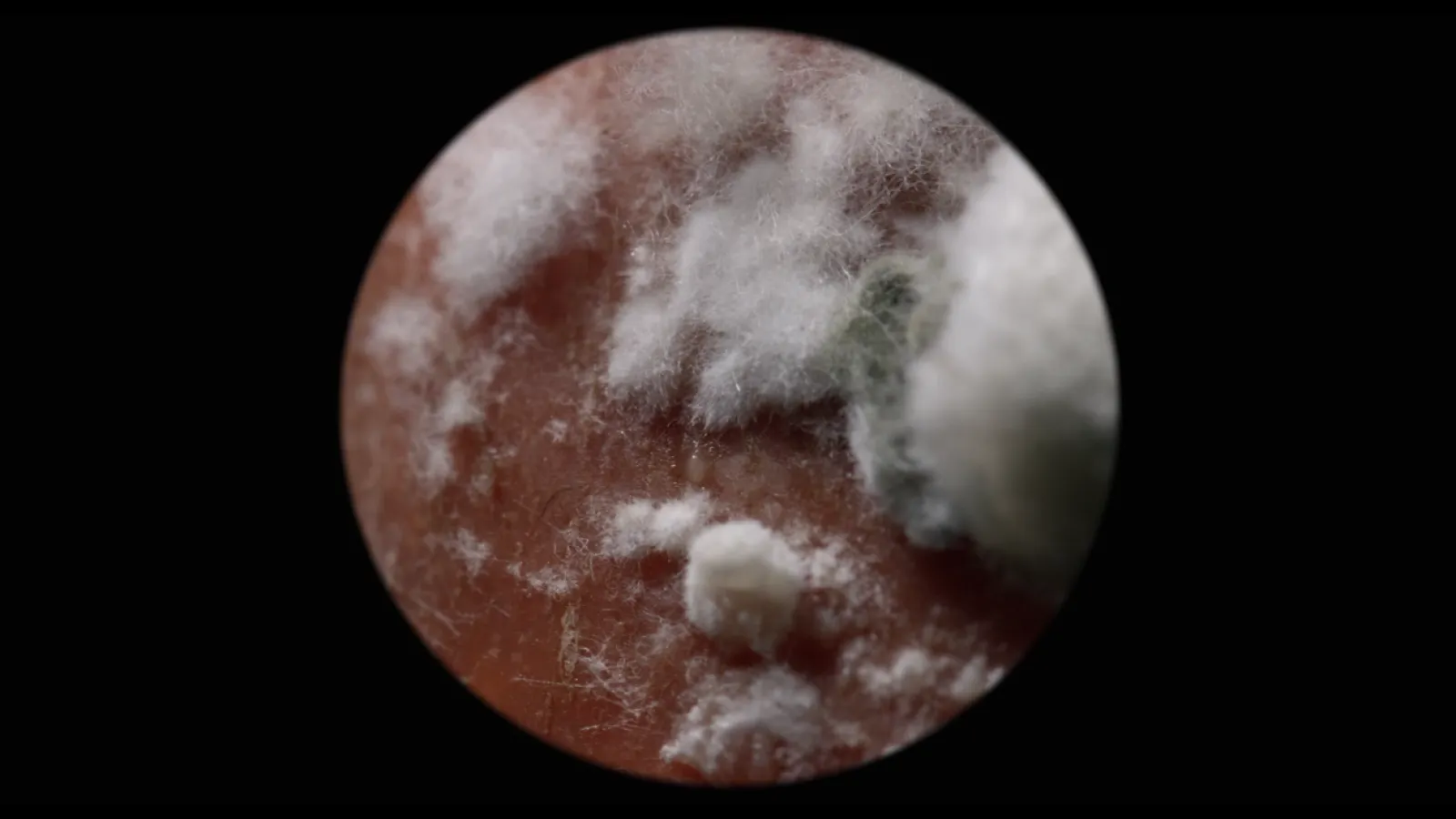 Dis-ease Documentary Video Thumbnail